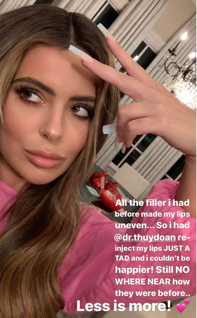 Brielle Biermann, Re-Injecting Lip Fillers